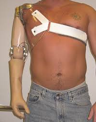 Omuz Dezartikülasyonu Protezi - ORTHOGEZ